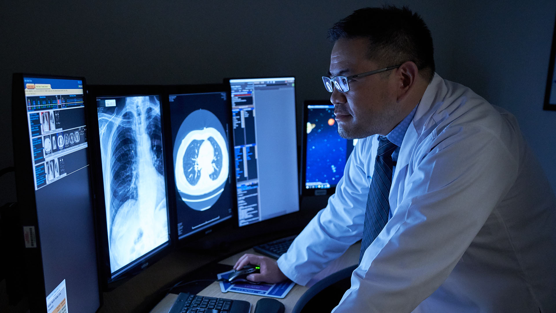 Study: AI, genetics, and clinical data improve breast cancer risk prediction